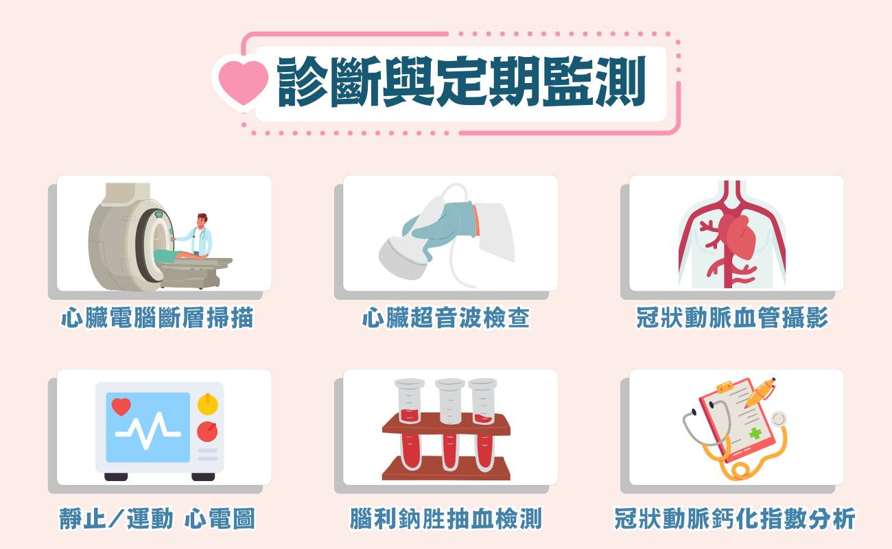 心肌梗塞診斷方式